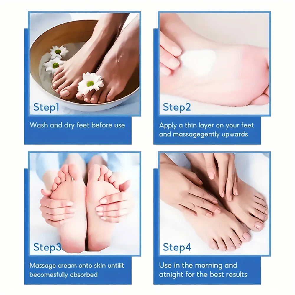 Urea Hand 42% and Foot Cream Softens Moisturizes Skin Relieves Dryness Repairs Cracks Exfoliates Deeply Penetrates Foot Cream